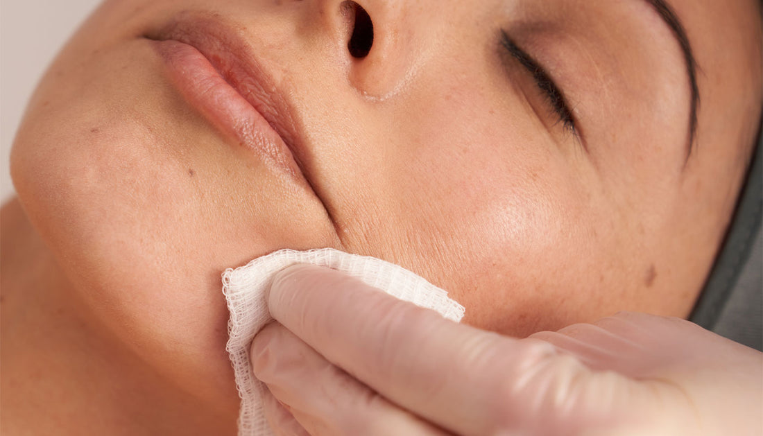 What is a chemical peel?