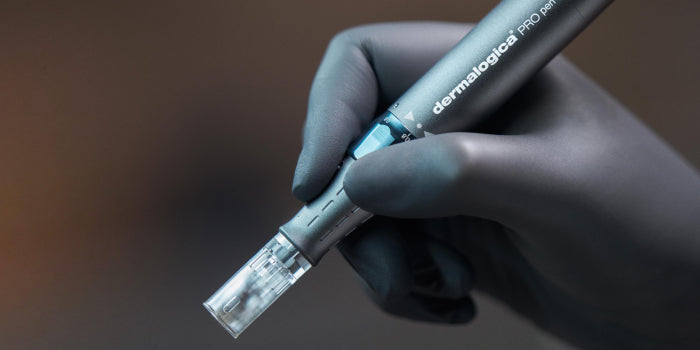 Microneedling: Benefits, Before and After Results & The Best Aftercare Routine