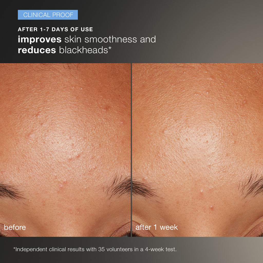 Daily Microfoliant Exfoliator