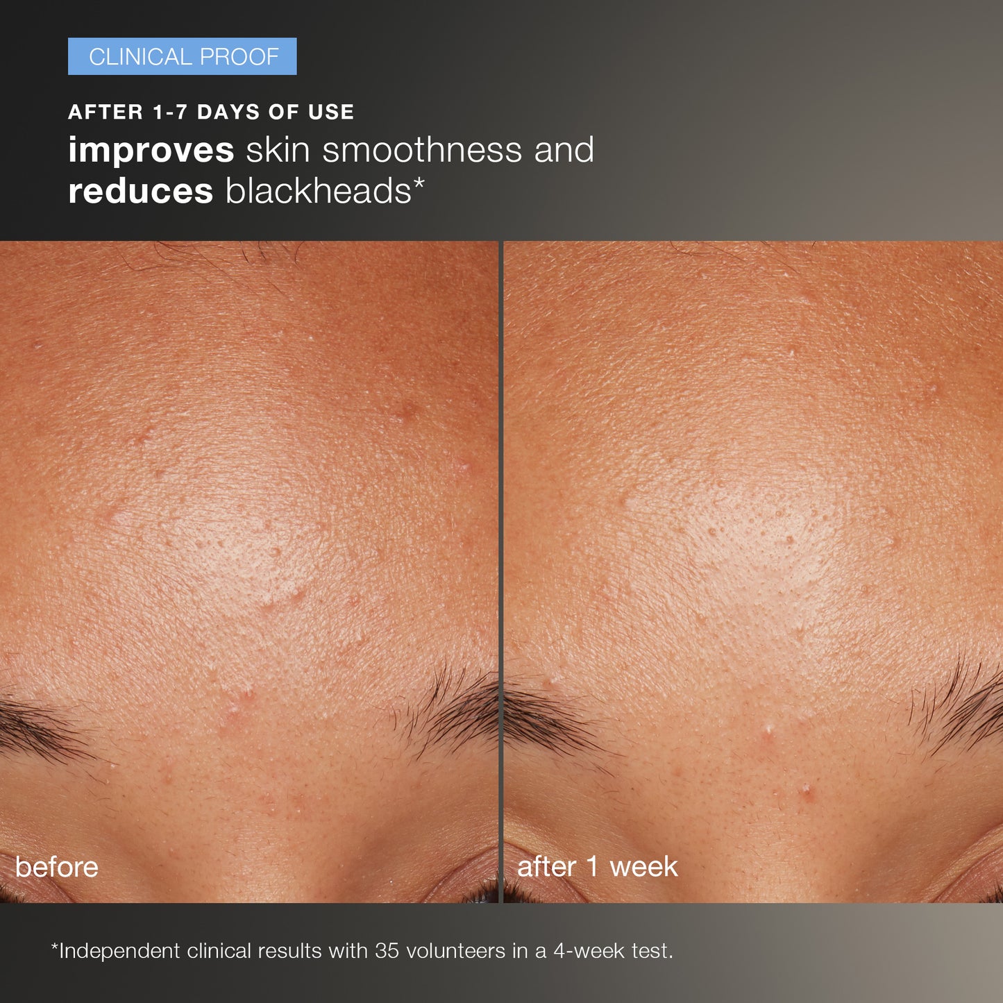 Daily Microfoliant Exfoliator