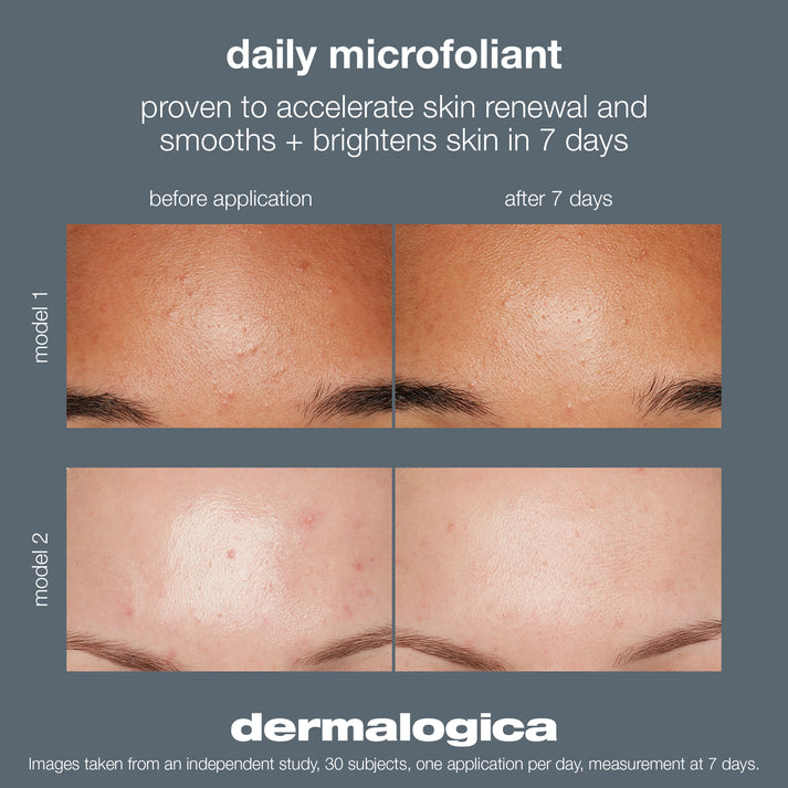 Daily Microfoliant, Powder Exfoliant, Rice Exfoliant Dermalogica