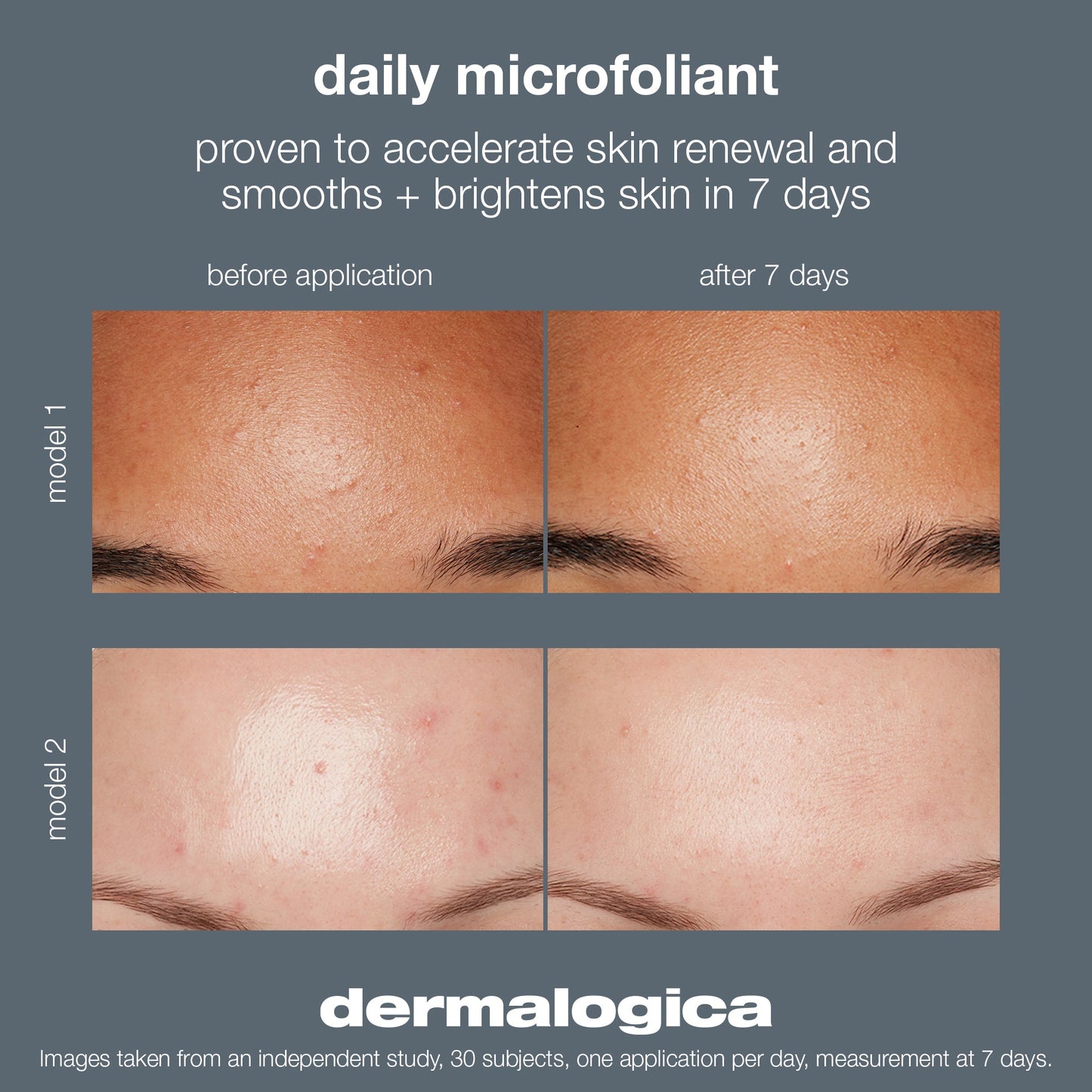 Daily Microfoliant before and after. Proven to accelerate skin renewal and smooths and brightens skin in 7 days. Based on an independent study with 30 subjects, one application per day.