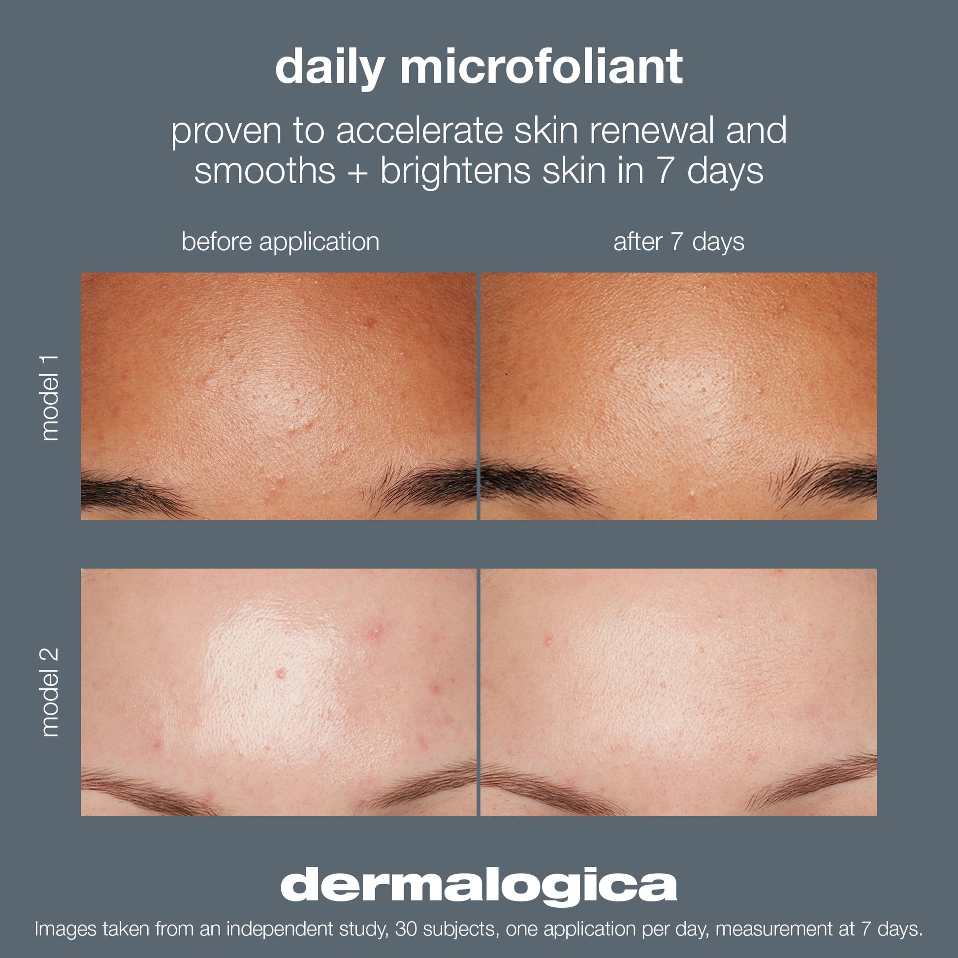 Daily Microfoliant before and after image. Proven to accelerate skin renewal and smooths and brightens skin in 7 days.