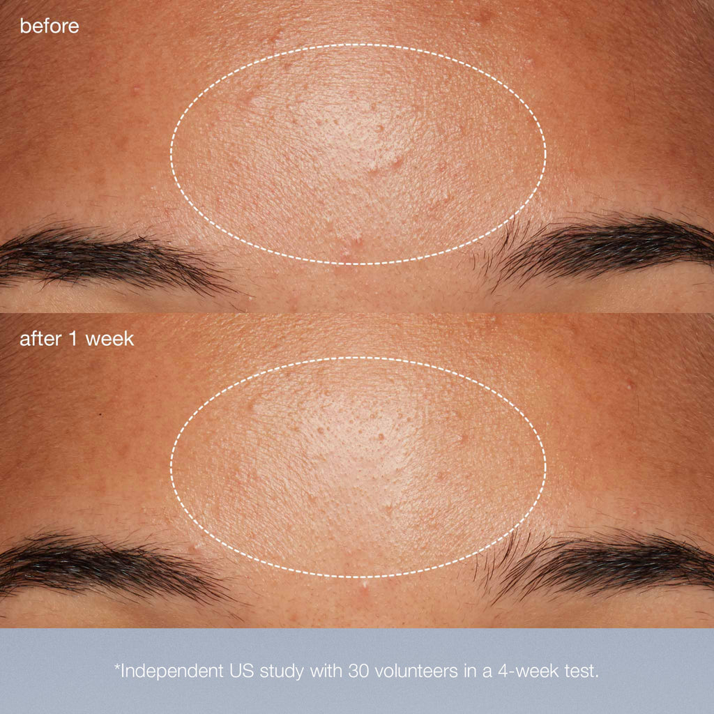 special cleansing gel + daily microfoliant