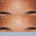 special cleansing gel + daily microfoliant