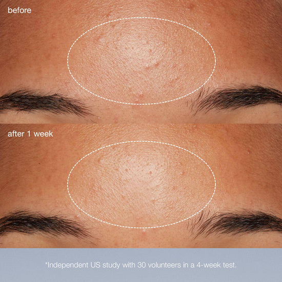 Daily Microfoliant, Powder Exfoliant, Rice Exfoliant Dermalogica