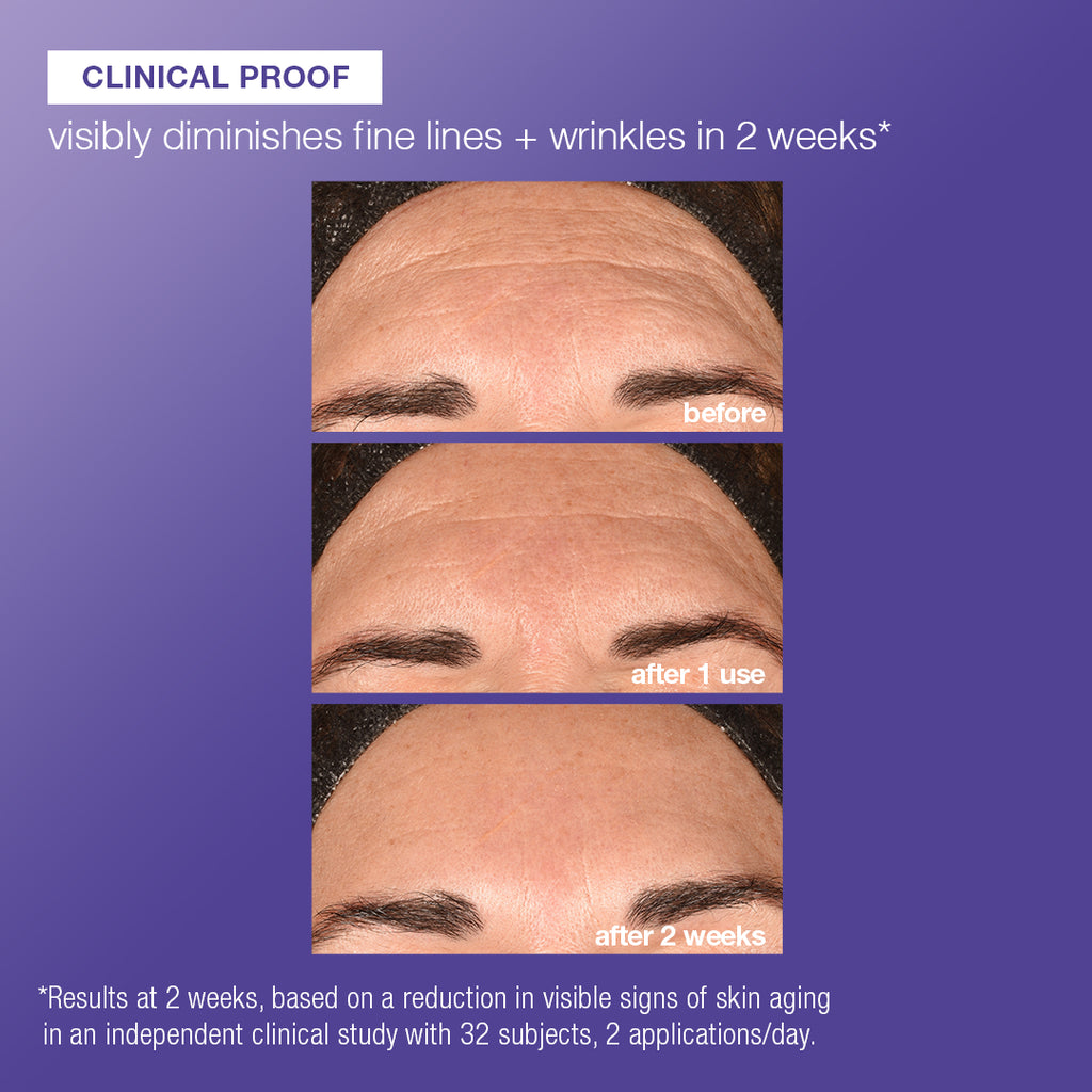 Phyto Nature E² Exosome Exfoliant