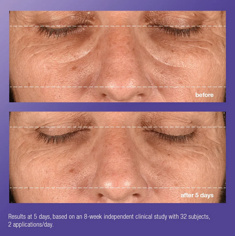 phyto nature e² regenerating daily exosome leave-on treatment