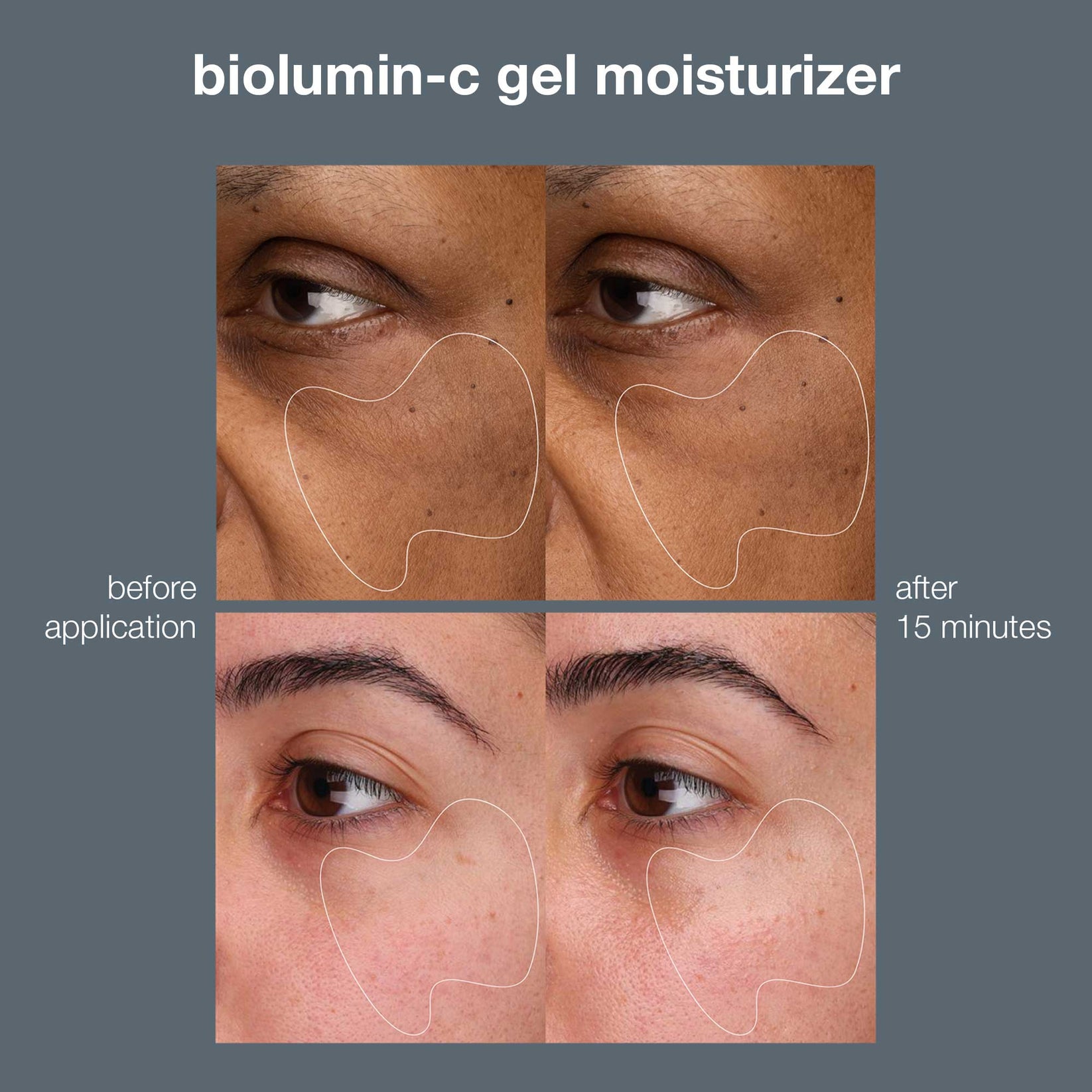 BioluminC Vitamin C Gel Moisturizer Dermalogica UK