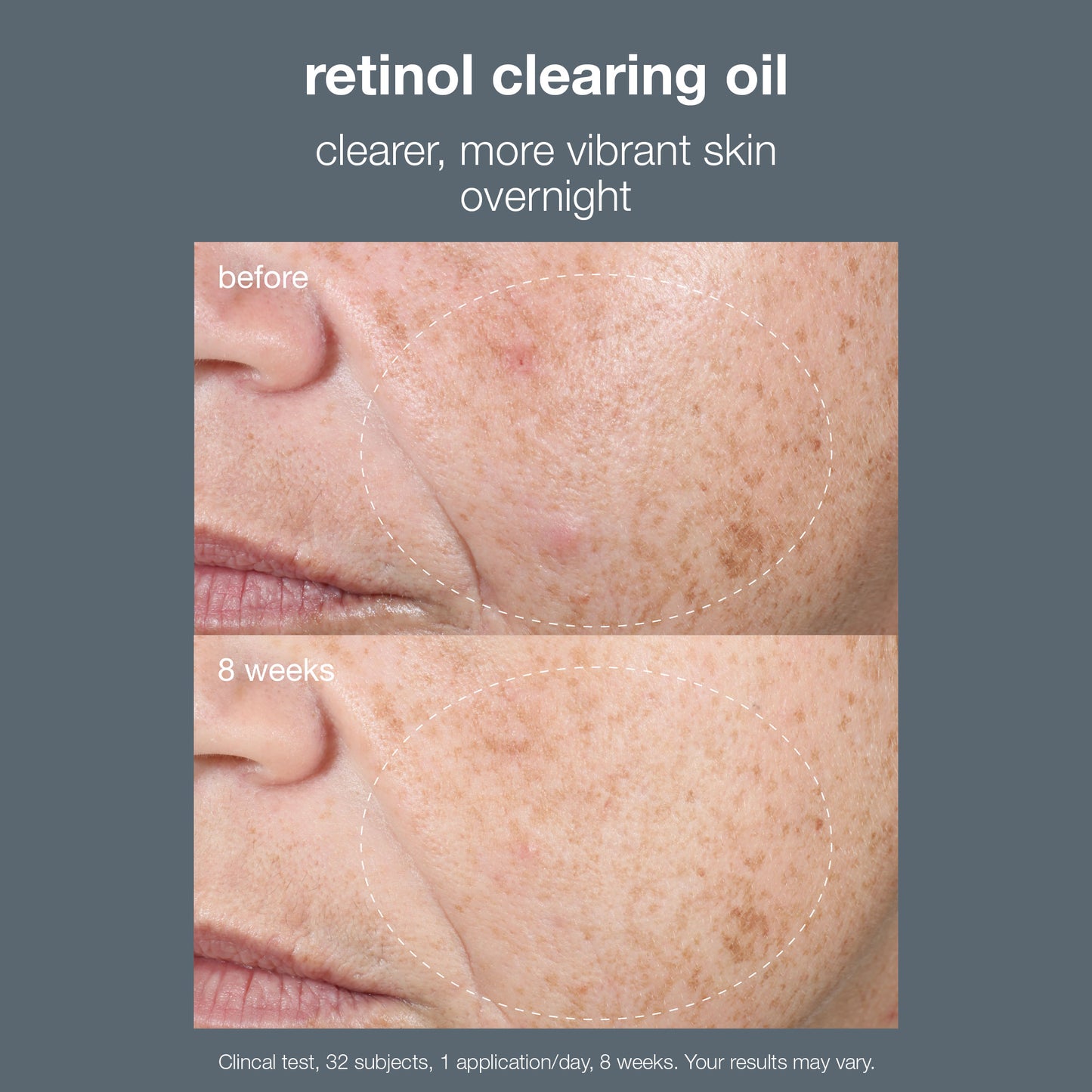 retinol clearing oil