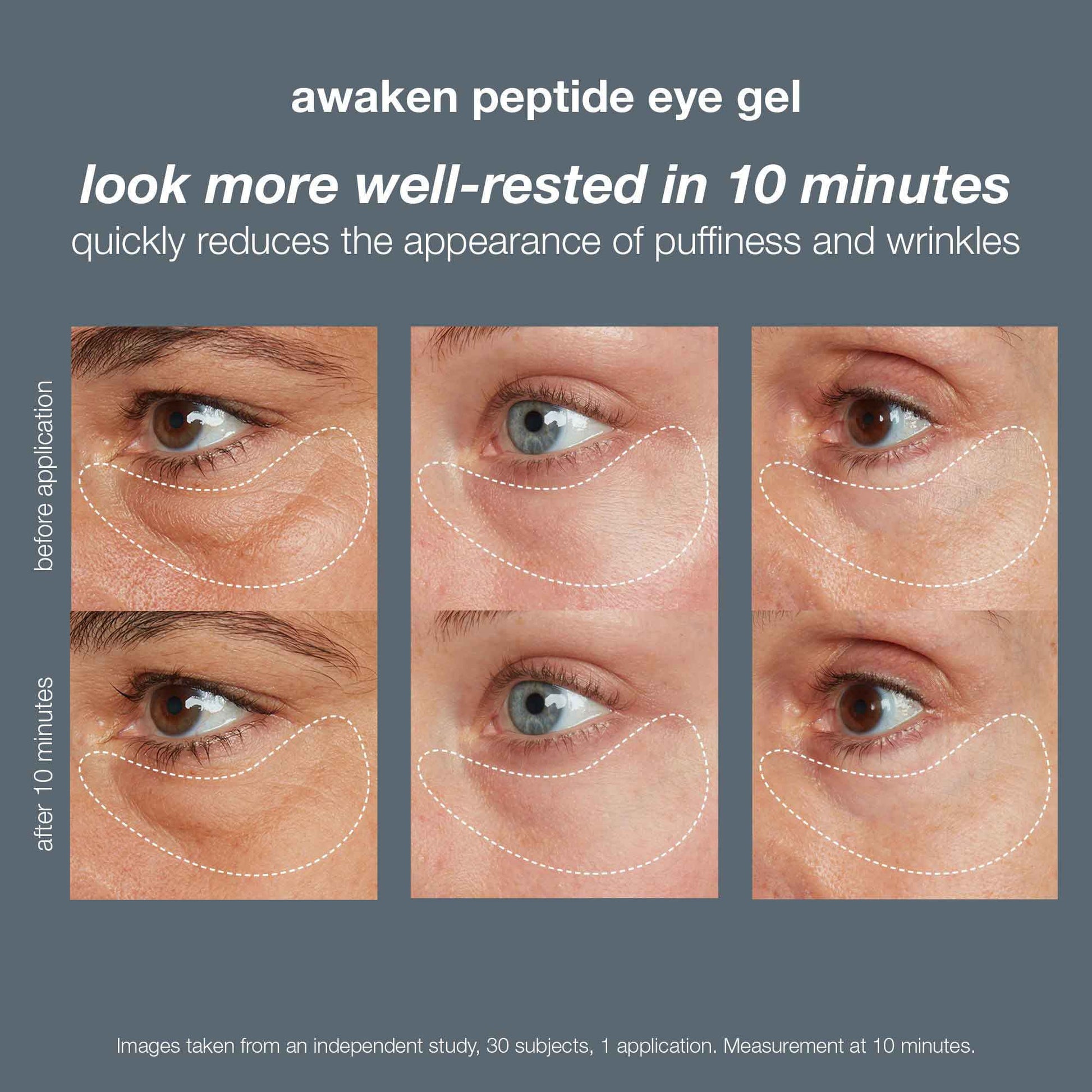 Awaken peptide eye gel before and after, look more well-rested in 10 minutes, quickly reduces the appearance of puffiness and wrinkles
